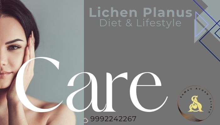 Lichen Planus - Diet & Lifestyle